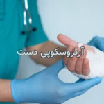 آرتروسکوپی دست