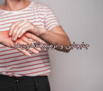 جابجایی و ترمیم تاندون‌ها