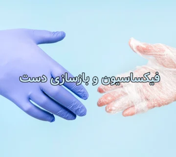 فیکساسیون و بازسازی دست