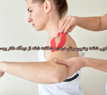 آرتروسکوپی شانه