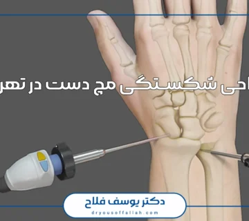 جراحی شکستگی مچ دست در تهران
