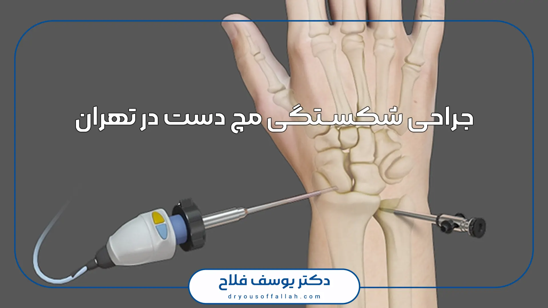 جراحی شکستگی مچ دست در تهران