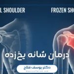 Prestige health wellness conditions frozen shoulder
