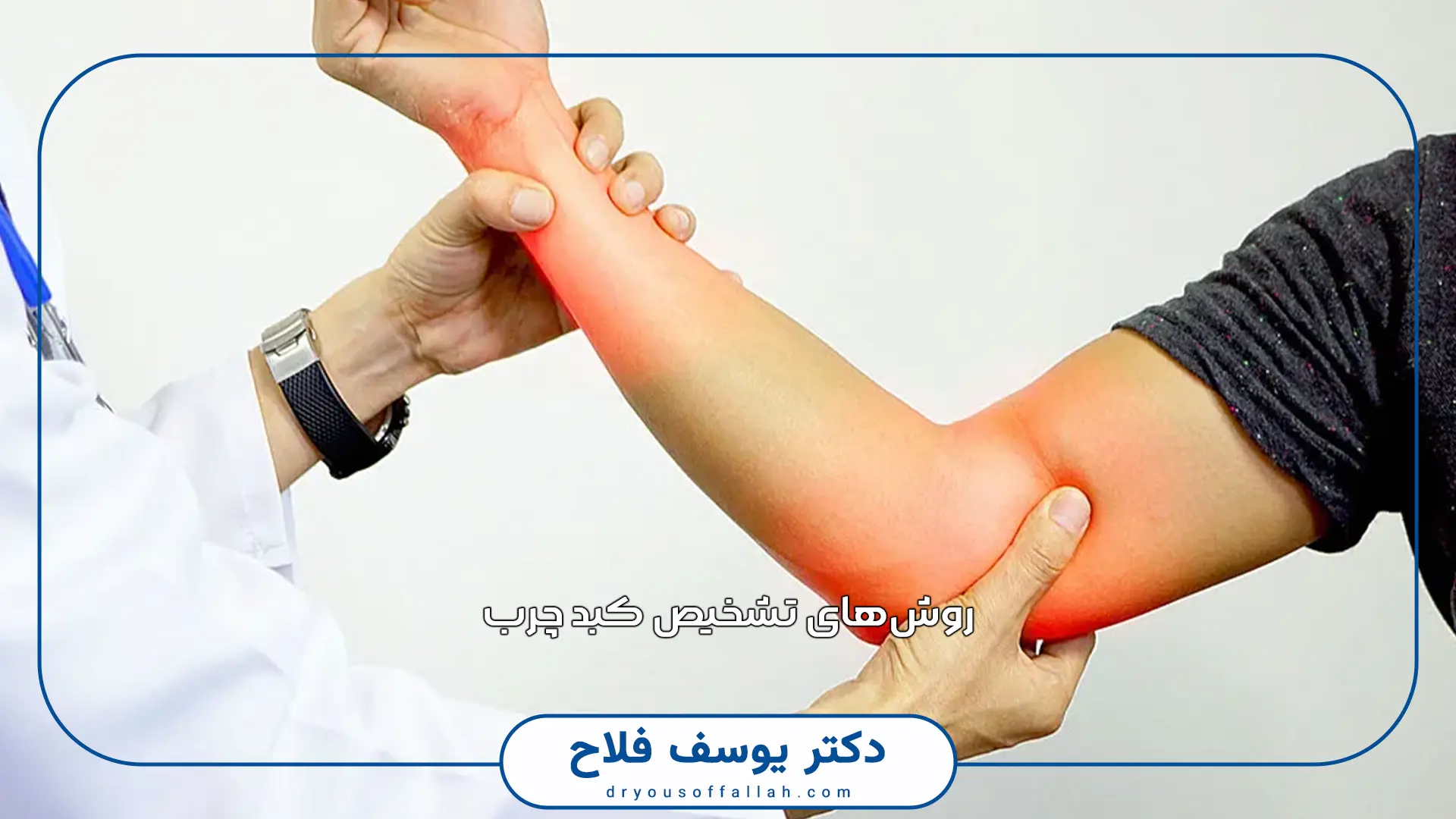 سندروم تونل کوبیتال