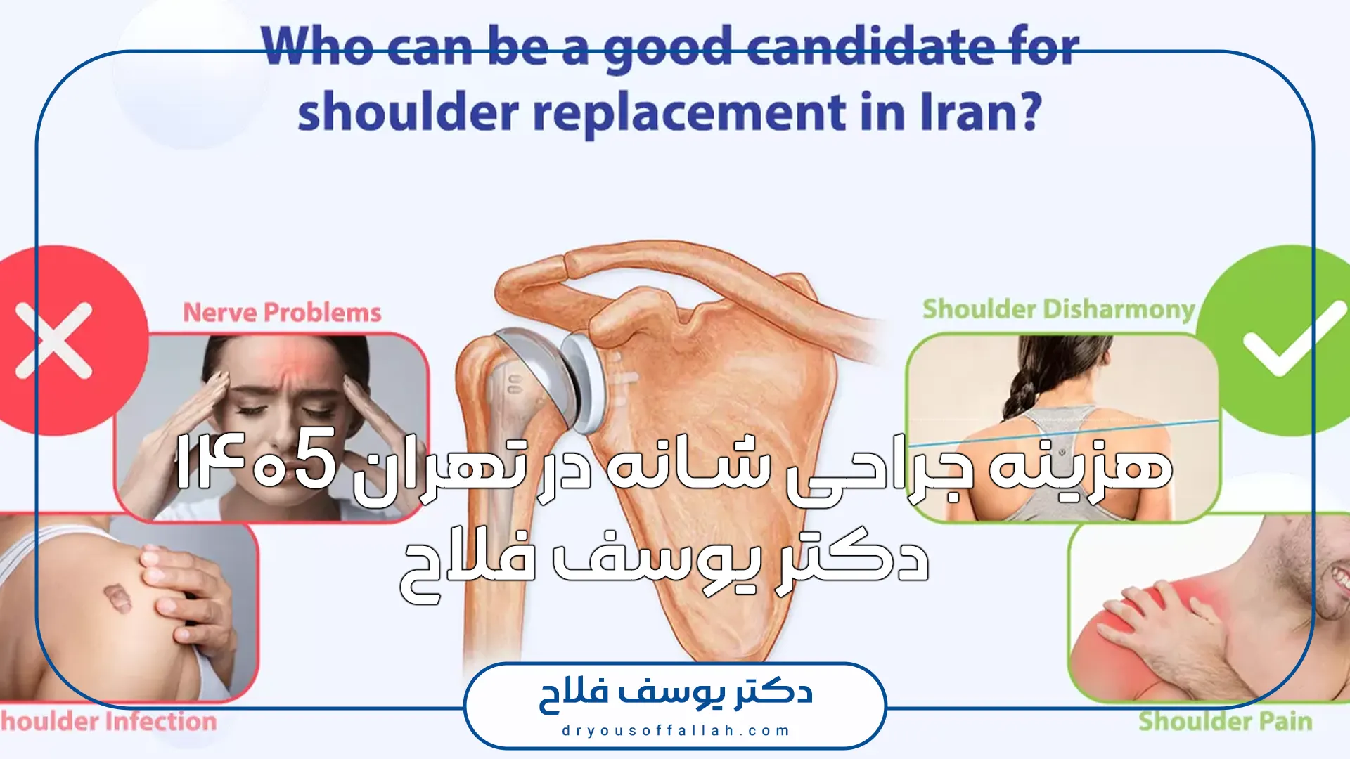 هزینه جراحی شانه در تهران