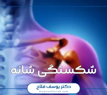 شکستگی شانه