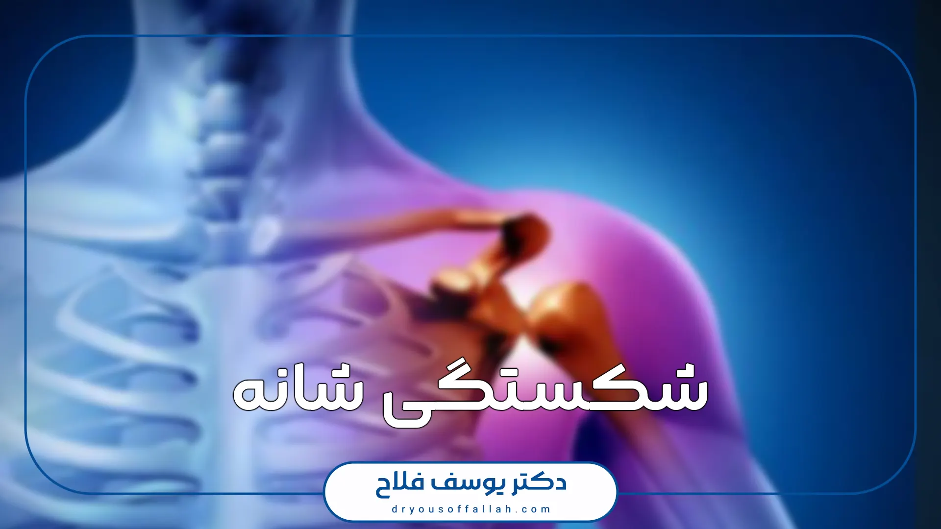 شکستگی شانه
