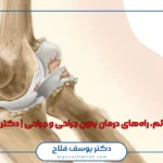 آرتروز آرنج؛ علائم، راه‌های درمان بدون جراحی و جراحی | دکتر یوسف فلاح