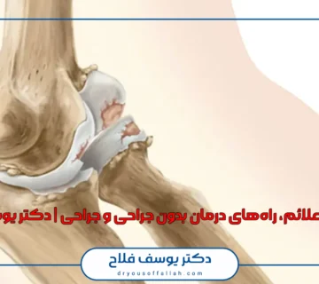 آرتروز آرنج؛ علائم، راه‌های درمان بدون جراحی و جراحی | دکتر یوسف فلاح
