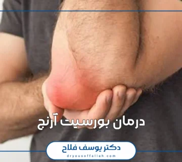 درمان بورسیت آرنج