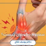 سندروم دکوروان چیست؟