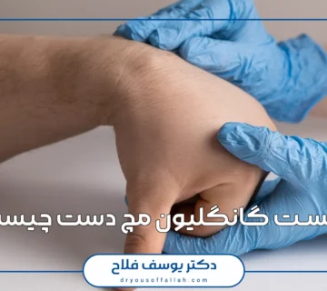 کیست گانگلیون مچ دست چیست