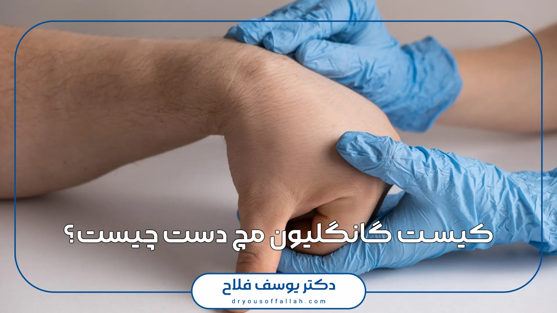 کیست گانگلیون مچ دست چیست